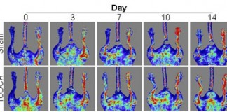 부작용 없는 새로운 줄기세포 유도인자 발견