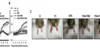 단백질 이용한 자가면역질환 신약후보물질 개발