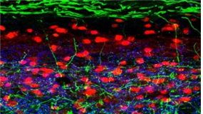 ‘근질근질’, 가려움을 긁게 하는 메커니즘 밝혀지다