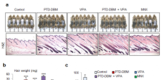 대머리 치료, 모낭 재생 물질 개발