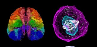 살아있는 인간의 뇌세포 정보 최초로 데이터베이스에 수록