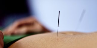 한의학 침치료, 뇌 기능 조절 “갱년기 우울증 잡는다”