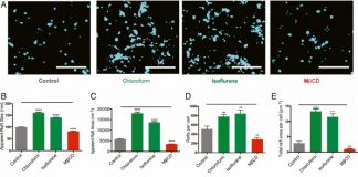 “왜 전신마취는 의식을 잃는지 메카니즘 밝혀져”