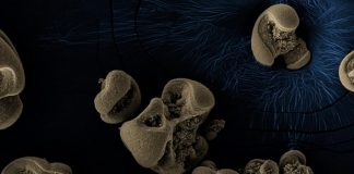 우연히 발견된 금속 먹는 박테리아