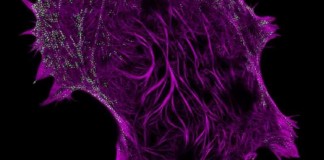 생체이미징, 45나노 까지 볼 수 있는 현미경 개발