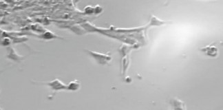 빛으로 줄기세포를 원하는 세포로 전환한다